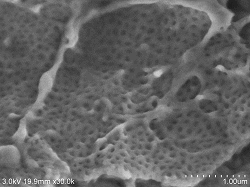 Glomerular-cleavage-conductive-staining